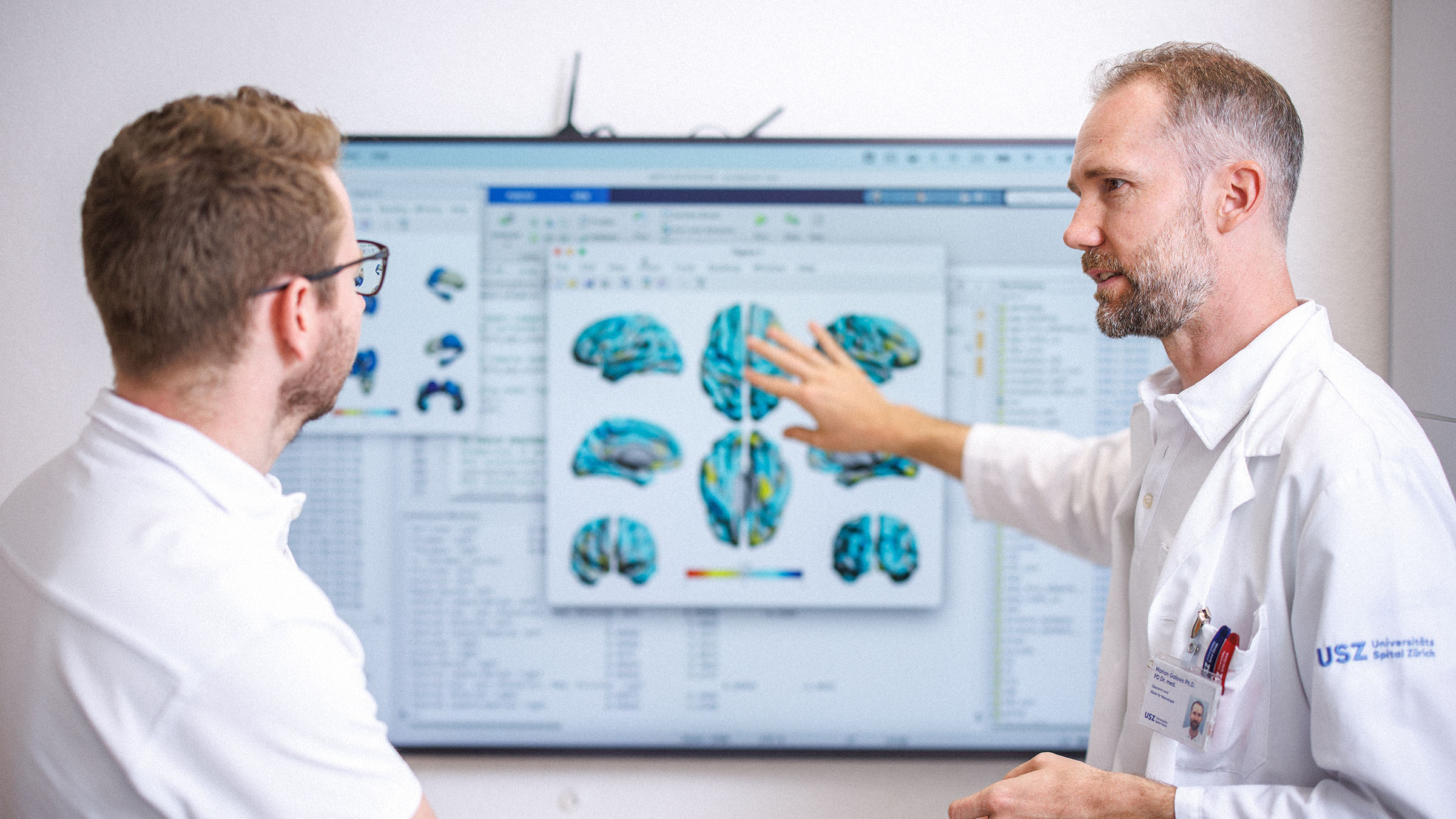 Researchers reviewing post-stroke brain imaging data